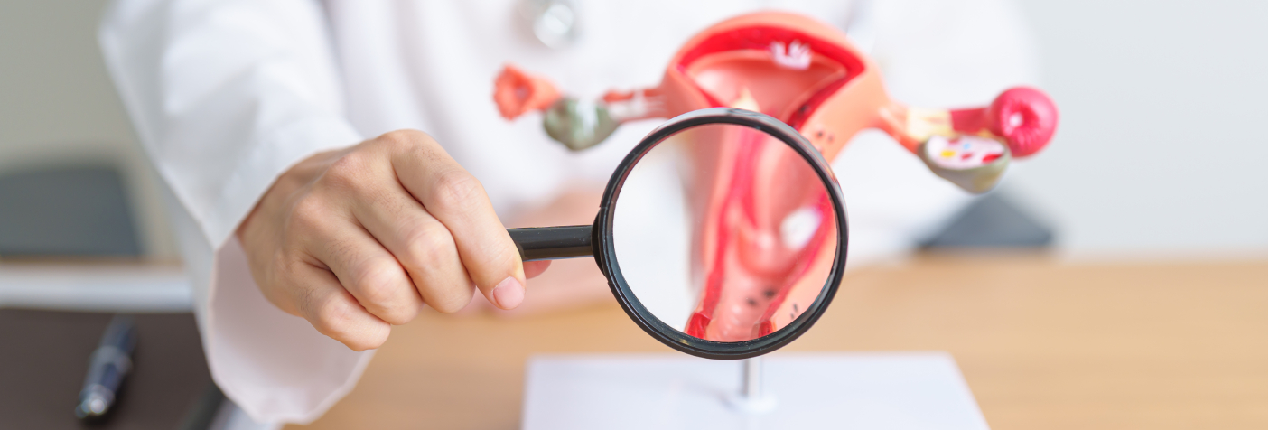 Uterine Polyps Treatment